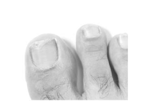 TERBINAFIN-1A Pharma Nagell.g.Nagelpilz 78.22mg/ml, 6.6 ml