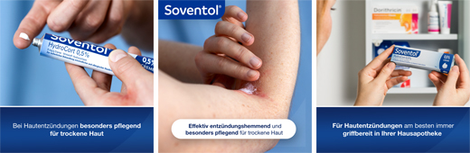 SOVENTOL Hydrocort 0,5%-os krém, 30 g