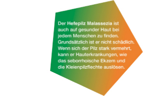 KETOZOLIN 2%-os sampon, 120 ml