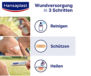 HANSAPLAST Zöld & Protect vakolatcsíkok, 20 db