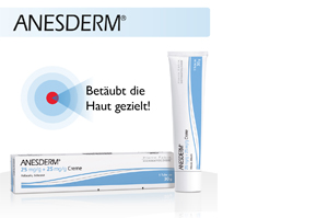 ANESDERM 25 mg/g + 25 mg/g krém + 2 tapasz, 5 g