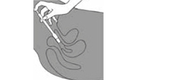 CLOTRIMAZOL AL 200 hüvelytabletta, 3 db