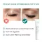 Benevi Neutral Eyelic Cream, 15 ml