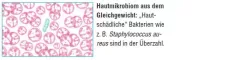 Instructions for use for AKTIVADERM ND Neurodermatitis bőr kezelésére aktív probiotikumok, 125 g - 2