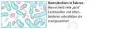 Instructions for use for AKTIVADERM ND Neurodermatitis bőr kezelésére aktív probiotikumok, 125 g - 3
