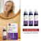 MINOXIDIL DoppelherzPharma 20 mg/ml oldat nőknek, 3X60 ml