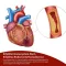 BEH Arteria+ kapszula, 30 db